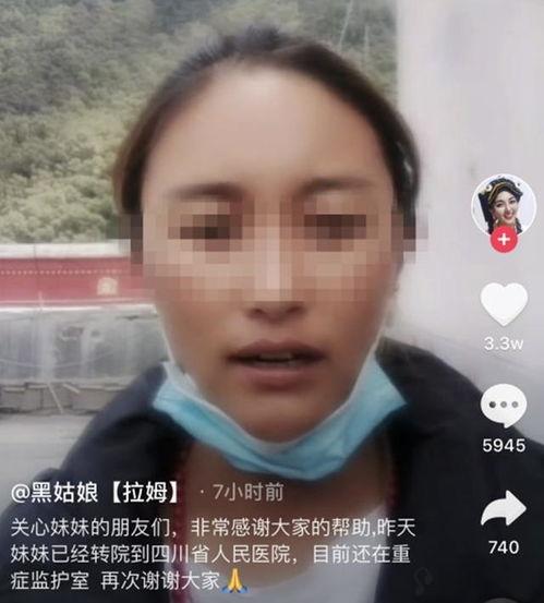 网红拉姆被烧伤前直播,网红拉姆被烧伤前的最后时刻