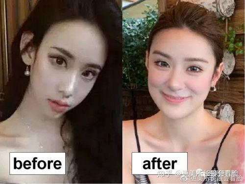 整容脸的明星,美丽背后的秘密与争议