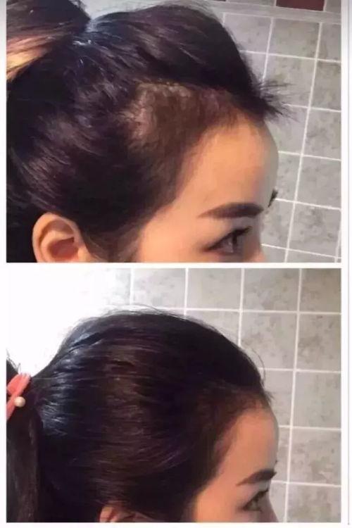 头发少图片,揭秘时尚新潮流